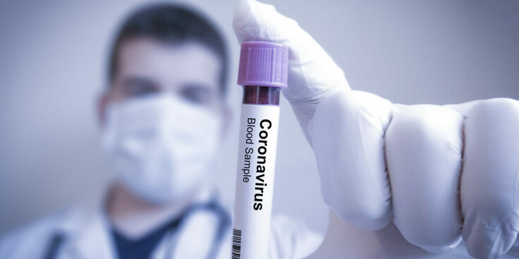 Le chiavi di accesso al coronavirus